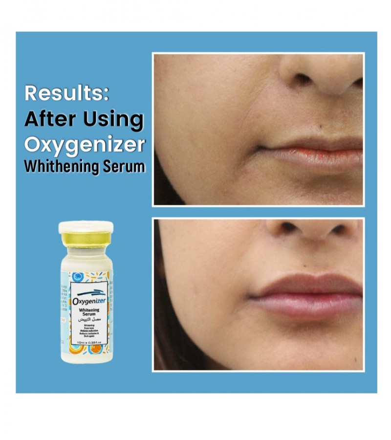 Dr Romia Oxignizer Whitening Serum 10ml